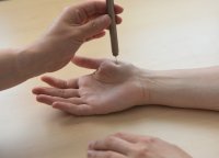 Bild: Bei der quantitativ sensorischen Testung (QST) wird die Empfindlichkeit des Patienten auf verschiedene Reize gemessen, beispielsweise auf spitze Reize. Eine Überempfindlichkeit für spitze Reize auf der nicht betroffenen Seite bei Patienten mit einseitigen Nervenverletzungen scheint ein Hinweis für eine zentralnervöse Störung der körpereigenen Schmerzhemmung zu sein. Bildnachweis: BG Universitätsklinikum Bergmannsheil