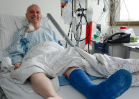 Roland Mündkemöller freut sich nach der überstandenen Herztransplantation: Heute soll nun der Gips vom Fuß entfernt werden (Foto Armin Kühn).