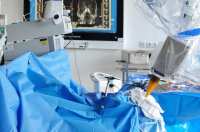 intraoperative Strahlentherapie (IORT) mittels Intrabeam
